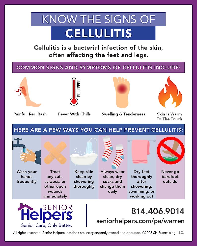 SH Cellulitis Flyer
