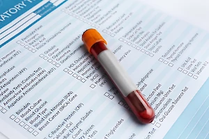 Common Blood Tests for Seniors